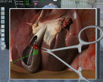 Surgery Simulator - PC Screen